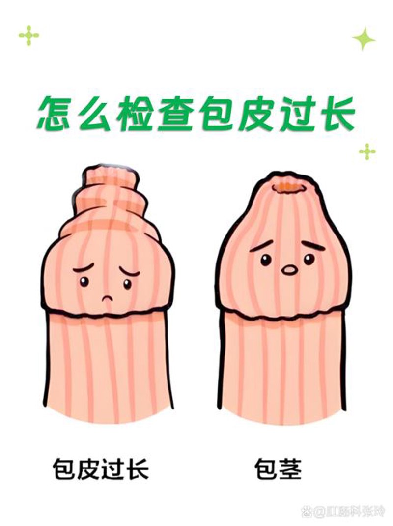 男性不育